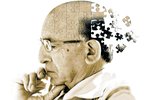 Alzheimer: Hver verður stefnan gagnvart lækningu á heilabilun í framtíðinni?