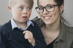 Erfiðara að berjast við kerfið en að eiga barn með Downs