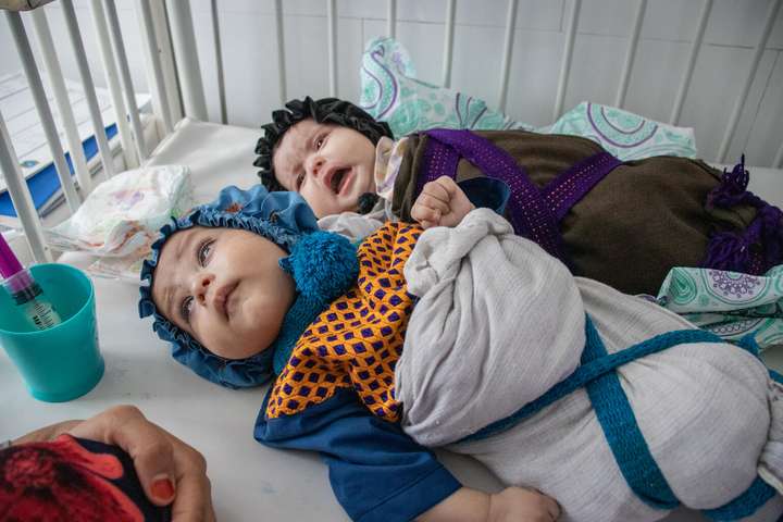 Milljónir barna í Afganistan munu glíma við bráðavannæringu næstu vikur